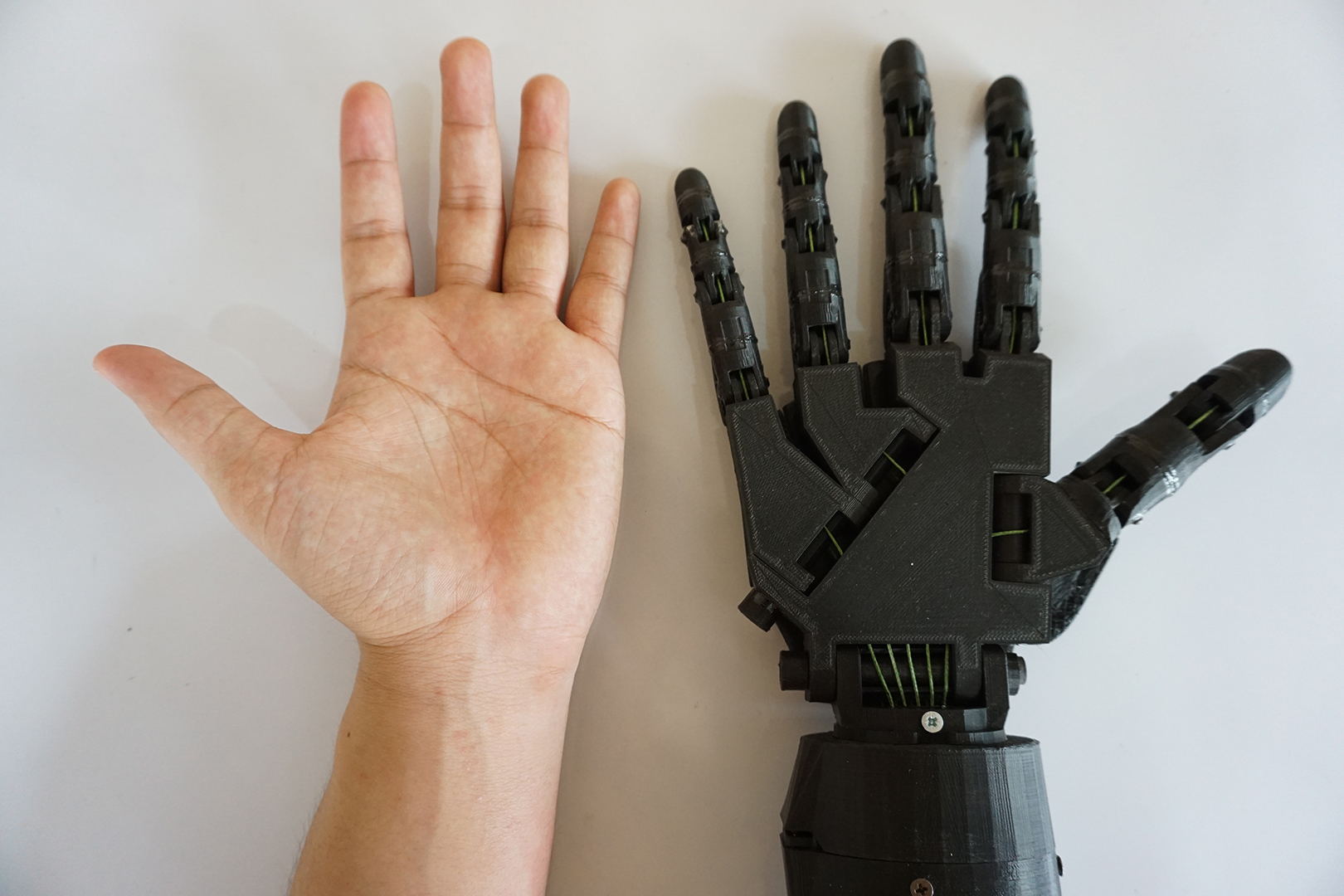 Designing a 3D-printed EMG bionic hand as a low-cost alternative to  prosthetic limbs