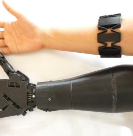 3D-Printed Myoelectric Hand Prosthesis - The IEEE Maker Project